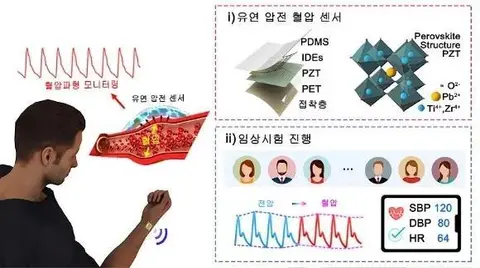 韩国标准科学研究院开发出可穿戴手表式血压传感器